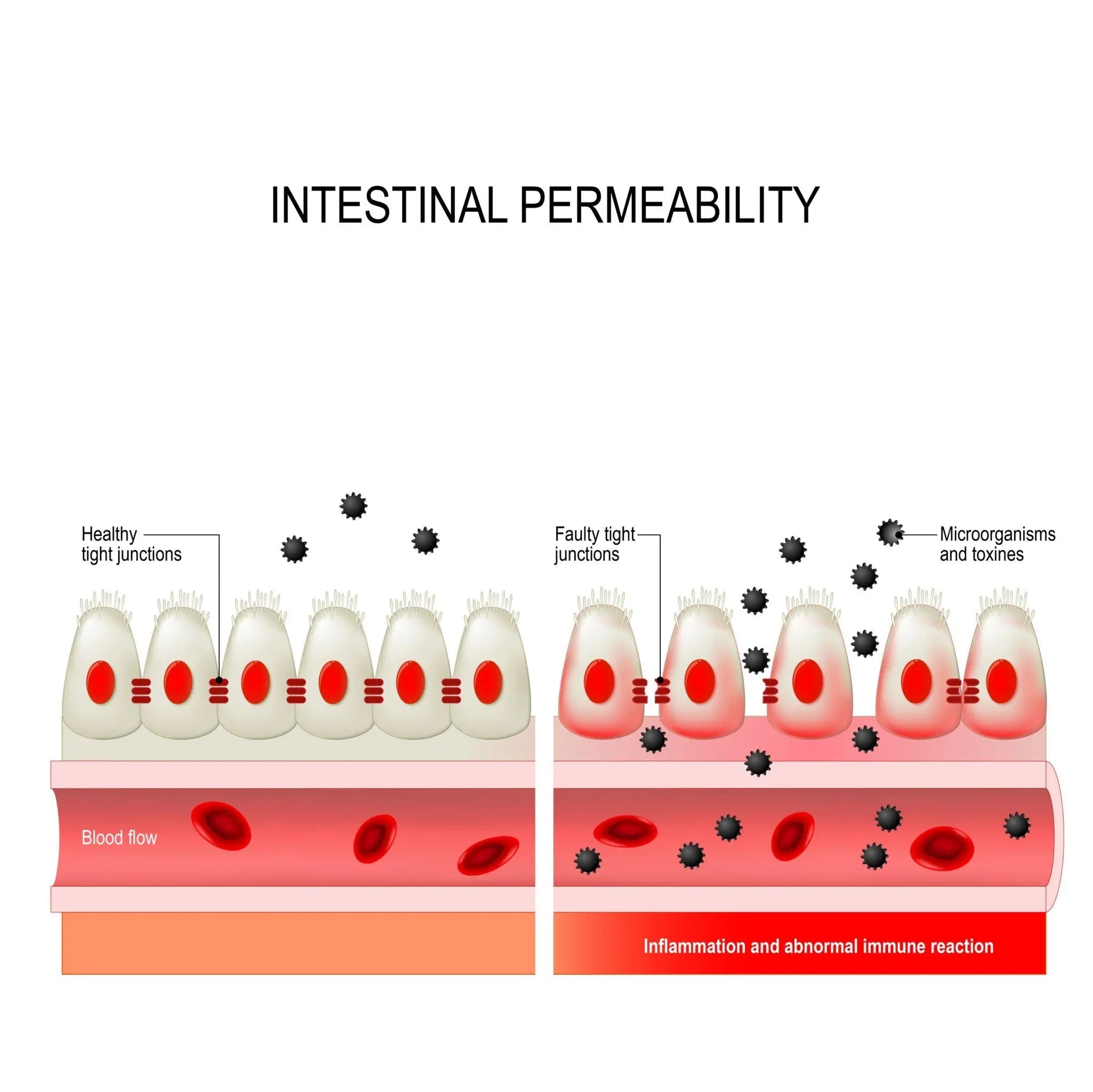 Beyond Collagen: Why BPC-157 is the Ultimate Fix for Leaky Gut Syndrome natuchoice
